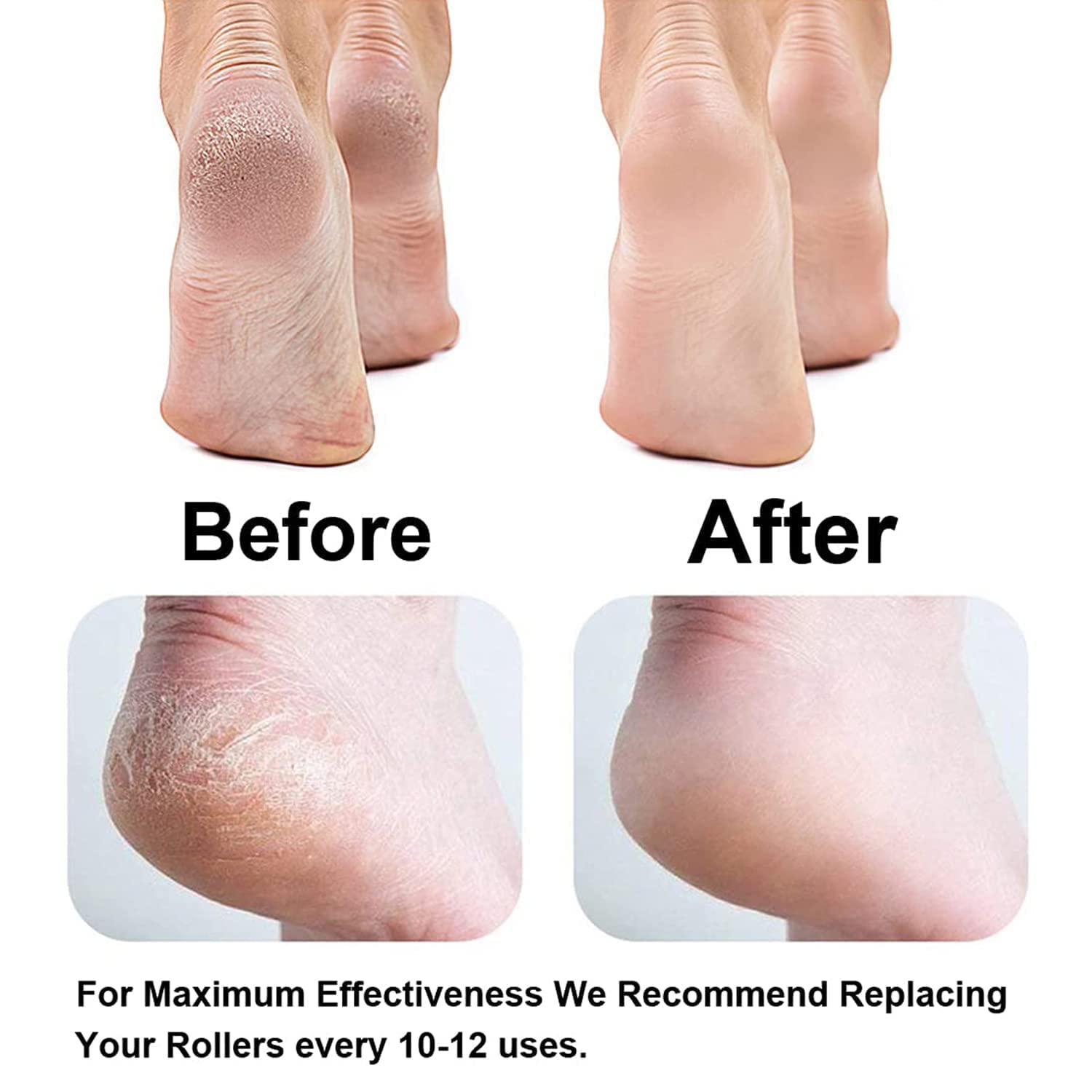 Step into Comfort: Rechargeable Callus Remover for Silky Smooth Feet